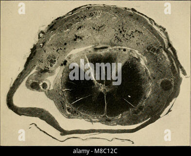 Malattie del sistema nervoso - un libro di testo di Neurologia e psichiatria (1915) (14779759881) Foto Stock