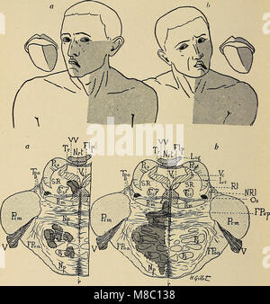 Malattie del sistema nervoso - un libro di testo di Neurologia e psichiatria (1915) (14802607203) Foto Stock