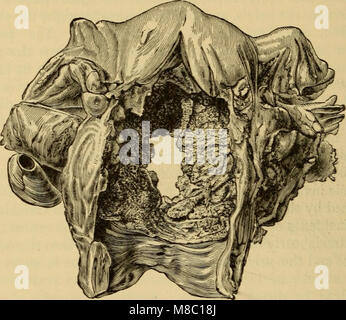 Malattie delle donne. Una guida clinica per la loro diagnosi e trattamento (1899) (14765108671) Foto Stock