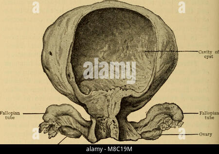 Malattie delle donne. Una guida clinica per la loro diagnosi e trattamento (1899) (14768348225) Foto Stock