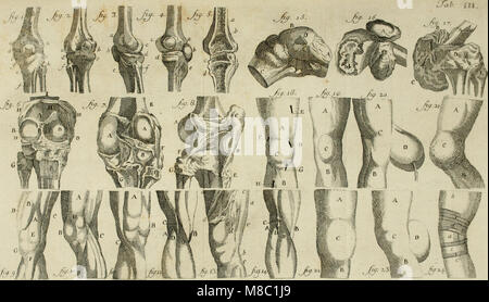 Disputationes fisico-medico anatomo-chirurgicae selectae (1756) (14780427492) Foto Stock