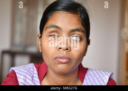 Agartala, India. Xiv Mar, 2018. Tenda indiana le ragazze sono iscritto in una scuola usando il Braille. Il Braille è una forma di linguaggio scritto per persone non vedenti, in cui i caratteri sono rappresentati da modelli di puntini in rilievo che si fanno sentire con la punta delle dita. Credito: Abhisek Saha/Pacific Press/Alamy Live News Foto Stock