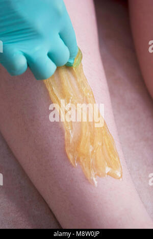 Rimozione dei capelli sulle donne per le gambe. Procedura zuccheraggio in un salone di bellezza. Depilazione di zucchero. Depilatoria pasta di zucchero Foto Stock