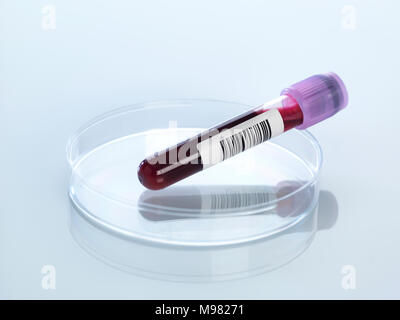 Campione di sangue in capsula di petri Foto Stock