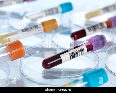 Il sangue umano e altri campioni di medici in capsule di petri Foto Stock