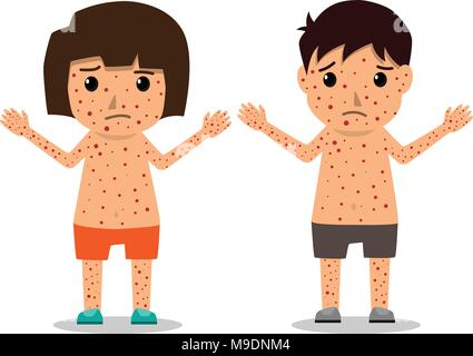 I bambini ha varicella Una infografica, Poster bambini febbre e sintomi di varicella e prevenzione. Health care personaggio dei fumetti illustrazione vettoriale. Illustrazione Vettoriale