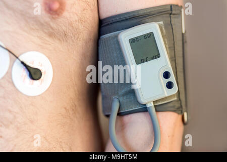 Monitor Holter device e quotidianamente la pressione del sangue sul registratore umano corpo maschio. Daily cardiogram monitoraggio. Il sovrappeso persona. Elevato rischio di malattia cardial. La cura della salute e la prevenzione delle malattie Foto Stock