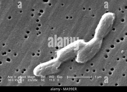 Quattro a forma di asta Gram-negative Salmonella Infantis batteri hanno rivelato nella scansione al microscopio elettronico (SEM) immagine, 2005. Immagine cortesia di centri per il controllo delle malattie (CDC) / Janice Haney Carr. () Foto Stock