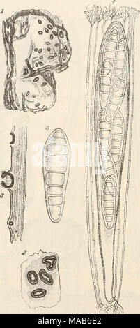 . Il dott. L. Rabenhorst's Kryptogamen-Flora von Deutschland, Oesterreich und der Schweiz . Fig. 1-5. Pseudographis pinicola. Fig. 1. Ein Eindenstück von Abies Pectinata mit dem Pilz in natürlicher Grösse. Fig. 2. Apothecien von oben ge- sehen. Fig. 3. Querdurchschnitt der Apothecien. Fig. 4. Schlauch mit para- physen. Fig. 5. Spora. (Fig. 2 u. 3 massig, Fig. 4 u. 5 stark vergrössert. Alles nach der Natur; Originalzeichnung). Foto Stock