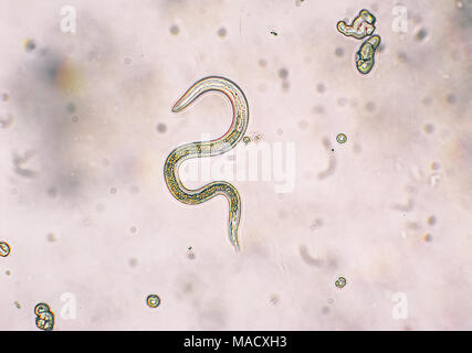 Toxocara canis secondo stadio larve hatch da uova nel microscopio. Toxocariasis, noto anche come nematode infezione, provoca la malattia negli esseri umani Foto Stock