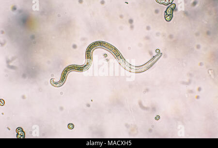 Toxocara canis secondo stadio larve hatch da uova nel microscopio. Toxocariasis, noto anche come nematode infezione, provoca la malattia negli esseri umani Foto Stock