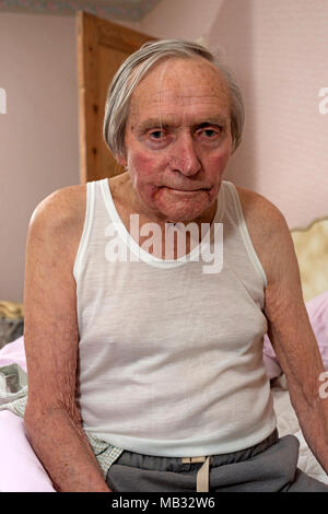 Uomo anziano seduto sul suo letto Foto Stock