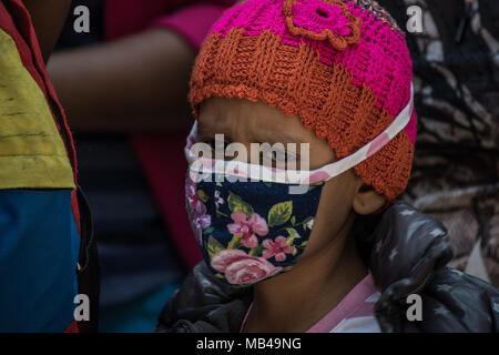 Caracas, Miranda, Venezuela. 6 apr, 2018. Un bambino malato visto la dimostrazione.i pazienti dal Dr JM de los Rios ospedale per bambini protesta al di fuori del centro di salute esigente di forniture mediche e la presenza del Ministro della Salute. Parenti denunciano la mancanza di farmaci, forniture mediche e che per questi motivi molti bambini hanno dovuto interrompere i loro trattamenti. Credito: Roman Camacho/SOPA Immagini/ZUMA filo/Alamy Live News Foto Stock