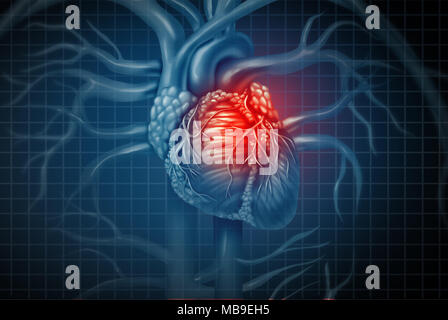 Attacco di cuore il dolore come un umano organo cardiovascolare con una dolorosa infiammazione cardiaca con 3D'illustrazione degli elementi. Foto Stock