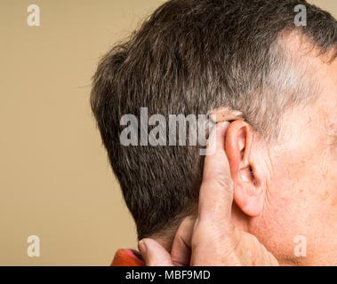 Senior uomo che indossa un piccolo e moderno hearing aid nascosto dietro l'orecchio Foto Stock