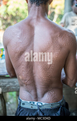 Cicatrici sulla schiena di un uomo Chambri a guardare come pelle di coccodrillo, Kanganaman village, Medio Sepik, Papua Nuova Guinea Foto Stock