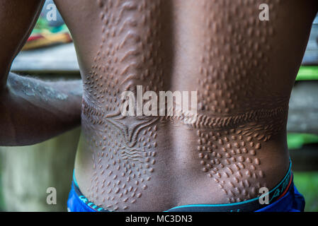 Dettaglio di cicatrici sulla schiena di un uomo Chambri a guardare come pelle di coccodrillo, Kanganaman village, Medio Sepik, Papua Nuova Guinea Foto Stock