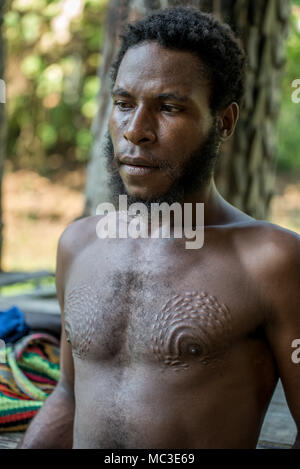 Cicatrici sul petto e i capezzoli di un uomo Chambri a guardare come pelle di coccodrillo, Kanganaman village, Medio Sepik, Papua Nuova Guinea Foto Stock