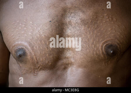 Cicatrici sul petto e i capezzoli di un uomo Chambri a guardare come pelle di coccodrillo, Kanganaman village, Medio Sepik, Papua Nuova Guinea Foto Stock