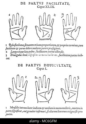 Chiromanzia sei palmi e le corrispondenti letture, relative al parto, da Johannes Taisnier, Opus Mathematicus, 1562. I primi tre di trattare con segni fissi in mano che garantiscono facilità di nascita delle donne. 1. Forte e ben proporzionata linee (specialmente nel triangolo, centrato sul palm) indicano un facile la nascita, con poco dolore. 2. Il singolo invertito l simbolo, sul Monte della Luna è un altro segno di facile la nascita. Un triangolo formato nello spazio al di sopra della linea di testa e al di sotto della linea del cuore, è ancora un altro indicatore della facilità di nascita. La parte inferiore tre invece offrire letture fissa delle mani Foto Stock