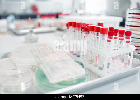 Provette con capsule di Petri sul tavolo nel dipartimento batteriologico del laboratorio Foto Stock