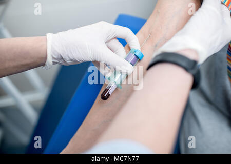 Assistente di laboratorio prelievo di sangue con capsula a depressione per test dalla vena del braccio in laboratorio Foto Stock