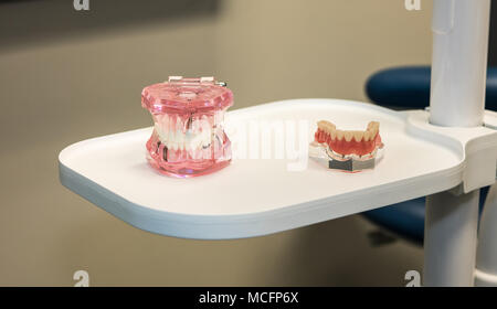 Mascellare superiore e inferiore modelli su un vassoio utilizzato in odontoiatria come strumenti educativi. Foto Stock