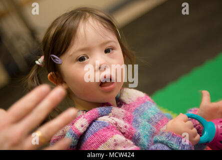 Bambina con sindrome di Downs Foto Stock