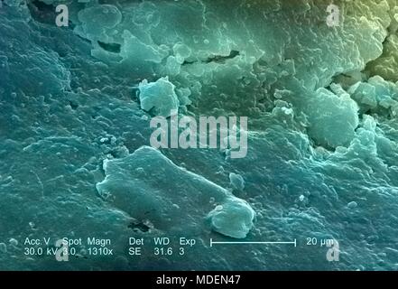 Caratteristiche morfologiche del gatto domestico (Felis domesticus) artiglio, rivelata nel 1310x di scansione ingrandita al microscopio elettronico (SEM) immagine, 2005. Immagine cortesia di centri per il controllo delle malattie (CDC) / Janice Haney Carr. Nota: l'immagine è stato colorizzato digitalmente usando un processo moderno. I colori possono non essere scientificamente accurate. () Foto Stock