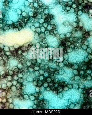 Più i virioni di virus della febbre gialla ha rivelato nella elevata trasmissione ingrandita al microscopio elettronico (TEM) immagine, 1980. Immagine cortesia di centri per il controllo delle malattie (CDC) / Erskine Palmer, Ph.D. Nota: l'immagine è stato colorizzato digitalmente usando un processo moderno. I colori possono non essere scientificamente accurate. () Foto Stock