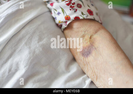 Senior in letto. Chiudere fino sulla vecchia donna mano. Foto Stock