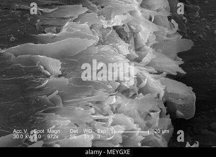 Caratteristiche morfologiche del gatto domestico (Felis domesticus) artiglio, rivelato nella 972x di scansione ingrandita al microscopio elettronico (SEM) immagine, 2005. Immagine cortesia di centri per il controllo delle malattie (CDC) / Janice Haney Carr. () Foto Stock