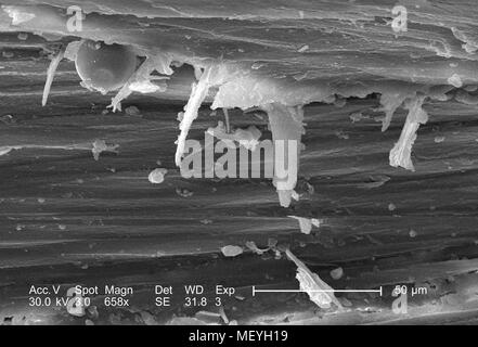 Caratteristiche morfologiche del gatto domestico (Felis domesticus) ago-artigli affilati, ha rivelato nel altamente scansione ingrandita al microscopio elettronico (SEM) immagine, 2005. Immagine cortesia di centri per il controllo delle malattie (CDC) / Janice Haney Carr. () Foto Stock