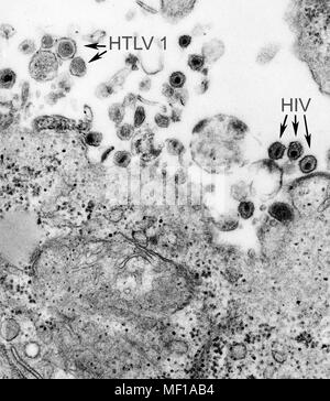 La presenza di entrambi i di leucemia a cellule T umana di tipo 1 (virus HTLV-1) e il virus di immunodeficienza umana (HIV) ha rivelato nella trasmissione microscopiche di elettroni (TEM) immagine, 1980. Immagine cortesia di centri per il controllo delle malattie (CDC) / Cynthia Goldsmith. () Foto Stock