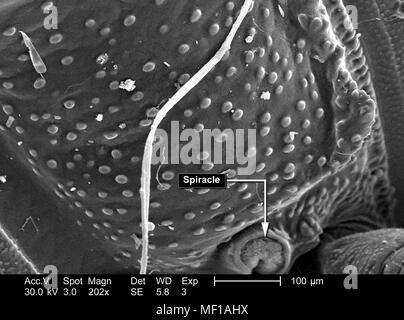 Le variazioni di configurazione di un millepiedi non identificato il corpo exoskeletal, raffigurato nella 202x di scansione ingrandita al microscopio elettronico (SEM) immagine, 2005. Immagine cortesia di centri per il controllo delle malattie (CDC) / Janice Haney Carr, Oren Mayer. () Foto Stock