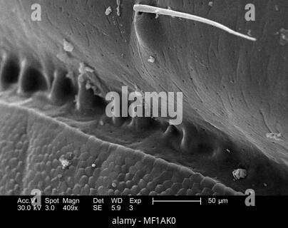 Le variazioni di configurazione di un millepiedi non identificato il corpo exoskeletal, raffigurato nella 409x di scansione ingrandita al microscopio elettronico (SEM) immagine, 2005. Immagine cortesia di centri per il controllo delle malattie (CDC) / Janice Haney Carr, Oren Mayer. () Foto Stock