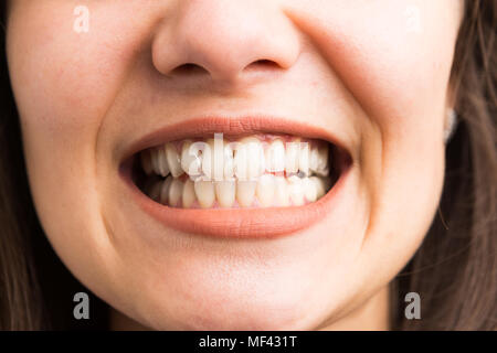 Giovane donna che mostra i suoi denti bianchi come igiene dentale concept Foto Stock