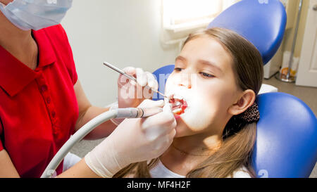 Ritratto di bambina apre la bocca mentre i suoi denti essendo forati da dentista Foto Stock