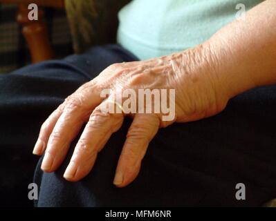 La mano di una donna anziana in appoggio sul suo ginocchio. Il suo dito è il suo oro anello di nozze. La mano mostra una vita di lavoro e fatica. Bandphoto / COMPULSOR Foto Stock