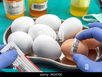 Marca scientifica con etichetta uova in cattive condizioni per esaminare in laboratorio clinico, immagine concettuale Foto Stock