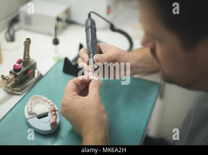 Dente artificiale che viene svolto da una protesi dentaria specialista. Foto Stock