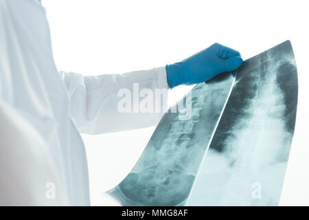 Medico analisi di raggi x della spina dorsale del paziente in un ambulatorio medico. Professionista del healthcare esaminando immagini di test per anomalie di scheletro umano. Foto Stock