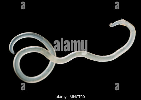 Un nematode parassita o nematode, che è stata rimossa dalla superficie di un pollack fegato di Inghilterra REGNO UNITO Foto Stock