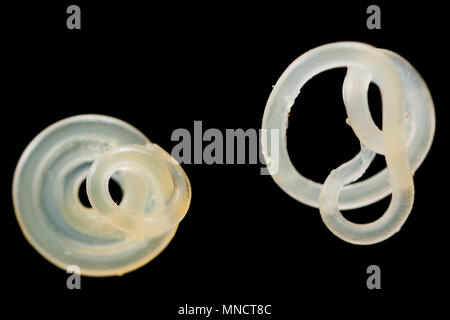 Nematodi parassiti o roundworms, che sono stati rimossi dalla superficie di un pollack il fegato . Inghilterra, Regno Unito Foto Stock