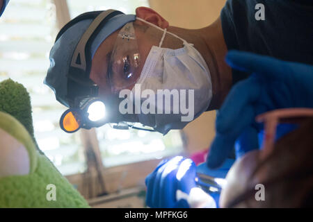 170227-N-WZ792-056 Trujillo, Honduras (feb. 27, 2017) - Lt. Farid Hamidzadeh, nativo di Fort Lauderdale, Florida, attaccato all'Ospedale Navale di Jacksonville, Fla. estrae un dente di una nazione ospite paitent presso il sito medico in Trujillo, Honduras durante continuando promessa 2017 (CP-17). CP-17 è un U.S. Comando sud-sponsorizzato e U.S. Forze Navali Comando meridionale/STATI UNITI 4a flotta-condotto di distribuzione condotta civile-militare comprendente le operazioni di assistenza umanitaria, formazione impegni, medico, dentista e supporto di veterinari in uno sforzo per mostrare il supporto degli Stati Uniti e di impegno a centrale e S Foto Stock