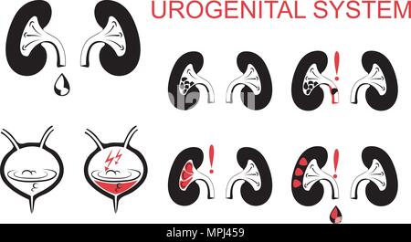 Illustrazione schematica del sistema urogenitale, dei reni e della vescica.urolitiasi, pielonefrite, glomerulonefrite rispetto i sintomi. Illustrazione Vettoriale