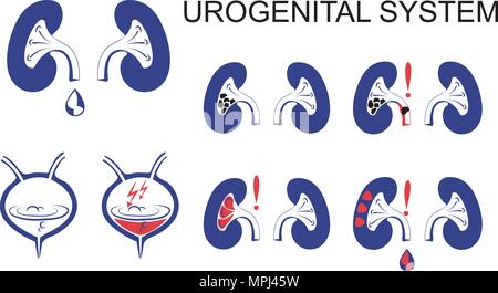 Illustrazione schematica del sistema urogenitale, dei reni e della vescica.urolitiasi, pielonefrite, glomerulonefrite rispetto i sintomi. Illustrazione Vettoriale