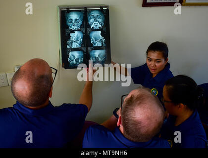 180518-N-QV906-386 NHA TRANG, Vietnam (18 maggio 2018) DEGLI STATI UNITI Navy professionisti medici assegnati ai militari di comando Sealift nave ospedale USNS misericordia (T-AH-19) ispezionare un candidato chirurgico tridimensionale scansione di ricostruzione durante un intervento di chirurgia plastica di consultazione. La misericordia è attualmente implementata in sostegno del Partenariato Pacifico 2018 (PP18). PP18's missione è lavorare collettivamente con host e nazioni partner per migliorare l'interoperabilità a livello regionale di emergenza e capacità di risposta, aumentare la stabilità e la sicurezza nella regione e favorire la nascita di nuove e durature amicizie in tutta la regione Indo-Pacifico. Pa Foto Stock