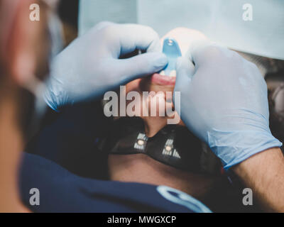 Medico che lavorano con dental fresatura CNC macchina. Spesialist preparare i denti del paziente per impiallacciature di ceramica con attrezzi speciali. Odontoiatria cosmetica, medicina, stomatologia concetto. Foto Stock