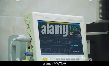 Elettrocardiogramma in chirurgia ospedaliera teatro operativo sala di emergenza che mostra frequenza cardiaca del paziente. Monitoraggio di segno vitale del paziente in sala operatoria. Monitor Cardiogram durante gli interventi chirurgici in sala operatoria. Foto Stock